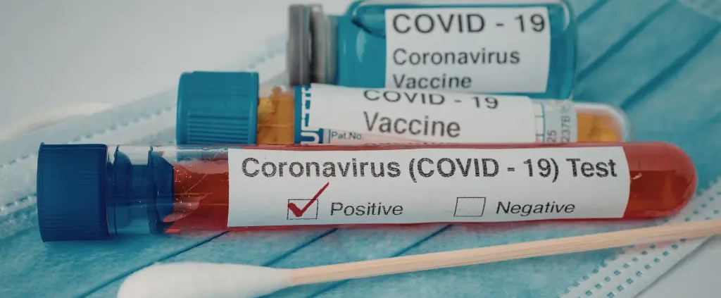 Cab Test Covid19 Coronavirus