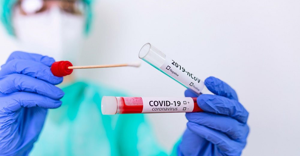 Tutti i test per il coronavirus: facciamo chiarezza!