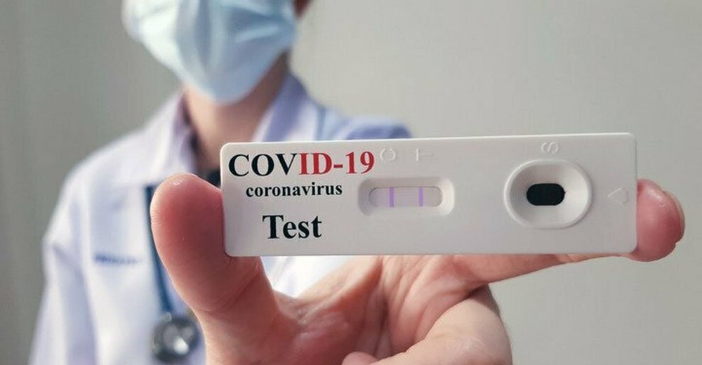 Test saliva Covid19